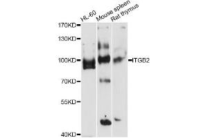Western blot analysis of extracts of various cell lines, using ITGB2 antibody (ABIN5971200) at 1/1000 dilution. (Integrin beta 2 Antikörper)