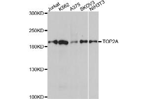 Western blot analysis of extracts of various cell lines, using TOP2A antibody (ABIN5970277) at 1/1000 dilution. (Topoisomerase II alpha Antikörper)