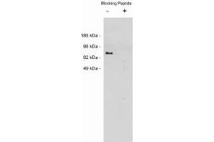 Image no. 1 for anti-Netrin 1 (NTN1) antibody (ABIN265183) (Netrin 1 Antikörper)