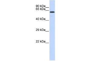 WB Suggested Anti-JMJD4 Antibody Titration:  0. (JMJD4 Antikörper  (N-Term))