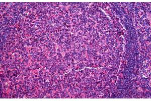 Human Tonsil: Formalin-Fixed, Paraffin-Embedded (FFPE) (CD48 Antikörper  (AA 1-170))