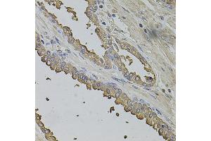 Immunohistochemistry of paraffin-embedded human prostate using FMR1NB antibody (ABIN5972990) at dilution of 1/100 (40x lens). (FMR1NB Antikörper)