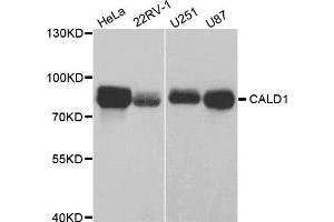 Western Blotting (WB) image for anti-Caldesmon 1 (CALD1) antibody (ABIN1876554) (Caldesmon Antikörper)