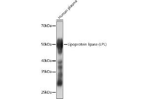 Western blot analysis of extracts of Human plasma, using Lipoprotein lipase (LPL) (LPL) Rabbit mAb (ABIN1682726, ABIN3018558, ABIN3018559 and ABIN7101626) at 1:1000 dilution. (Lipoprotein Lipase Antikörper)