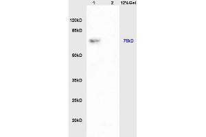 Lane 1: rat kydney lysates Lane 2: rat brain lysates probed with Anti PAP-? (PAPOL A+B+G Antikörper)