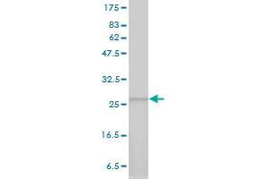 Western Blotting (WB) image for anti-Proteasome Subunit alpha  7 (PSMA7) (AA 1-248) antibody (ABIN562474)