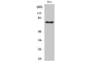 Western Blotting (WB) image for anti-Nuclear Factor-kB p65 (NFkBP65) (pSer529) antibody (ABIN5961223) (NF-kB p65 Antikörper  (pSer529))