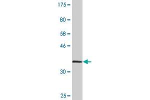 Western Blot detection against Immunogen (36. (Catalase Antikörper  (AA 1-100))