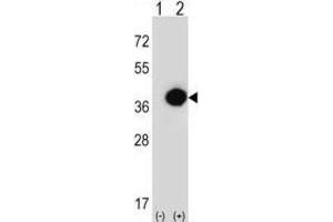 Western Blotting (WB) image for anti-Phytanoyl-CoA 2-Hydroxylase (PHYH) antibody (ABIN3003880) (PHYH Antikörper)