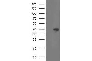 HEK293T cells were transfected with the pCMV6-ENTRY control (Left lane) or pCMV6-ENTRY RLBP1 (Right lane) cDNA for 48 hrs and lysed. (RLBP1 Antikörper)