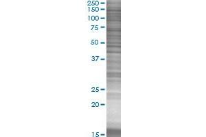 Western Blotting (WB) image for GOLGA2 293T Cell Transient Overexpression Lysate(Denatured) (ABIN1331989)