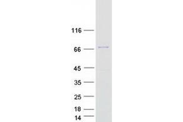 TRMT2A Protein (Transcript Variant 2) (Myc-DYKDDDDK Tag)