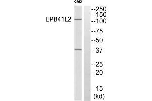 Western Blotting (WB) image for anti-erythrocyte Membrane Protein Band 4.1-Like 2 (EPB41L2) (Internal Region) antibody (ABIN1850881) (EPB41L2 Antikörper  (Internal Region))