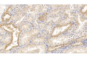 Detection of GITR in Human Kidney Tissue using Polyclonal Antibody to Glucocorticoid Induced Tumor Necrosis Factor Receptor (GITR) (Glucocorticoid Induced Tumor Necrosis Factor Receptor (AA 39-152) Antikörper)