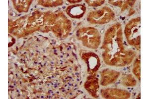 IHC image of ABIN7170916 diluted at 1:300 and staining in paraffin-embedded human kidney tissue performed on a Leica BondTM system. (SUCLG2 Antikörper  (AA 161-292))