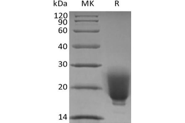 FNDC5 Protein (His tag)