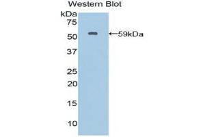 Western Blotting (WB) image for anti-Moesin (MSN) (AA 354-577) antibody (ABIN1859888) (Moesin Antikörper  (AA 354-577))
