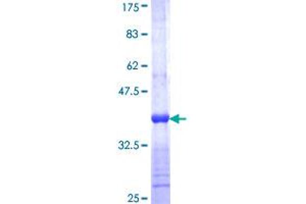 FANCC Protein (AA 1-100) (GST tag)