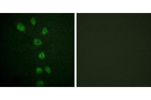 P-peptide - +Immunofluorescence analysis of HepG2 cells, using GATA4 (Phospho-Ser105) antibody. (GATA4 Antikörper  (pSer105))