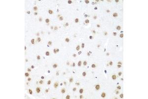 Immunohistochemistry of paraffin-embedded mouse brain using DDX39B antibody (ABIN5974669) at dilution of 1/100 (40x lens). (DDX39B Antikörper)