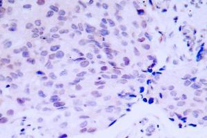 Image no. 2 for anti-Retinoblastoma 1 (RB1) antibody (ABIN271803) (Retinoblastoma 1 Antikörper)