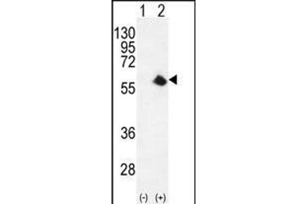 CDK8 Antikörper  (AA 249-277)