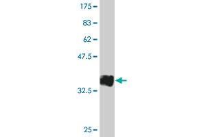 Western Blot detection against Immunogen (35. (CD19 Antikörper  (AA 98-187))