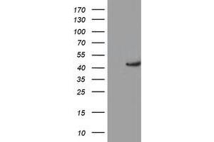 Western Blotting (WB) image for anti-Potassium Voltage-Gated Channel, Shaker-Related Subfamily, beta Member 1 (KCNAB1) antibody (ABIN1498998) (KCNAB1 Antikörper)