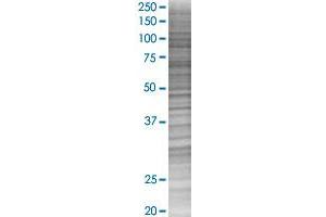 LMO2 transfected lysate. (LMO2 293T Cell Transient Overexpression Lysate(Denatured))