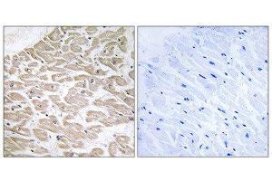 Immunohistochemistry (IHC) image for anti-Ras-Related Associated with Diabetes (RRAD) (Internal Region) antibody (ABIN1851412) (RRAD Antikörper  (Internal Region))