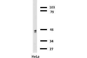 Western blotting analysis of cytokeratin 18 in HeLa cells with anti-cytokeratin 18 biotin. (Cytokeratin 18 Antikörper  (Biotin))