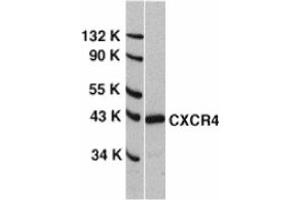 Image no. 1 for anti-Chemokine (C-X-C Motif) Receptor 4 (CXCR4) (N-Term) antibody (ABIN201184) (CXCR4 Antikörper  (N-Term))