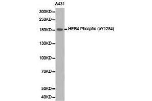 Western Blotting (WB) image for anti-V-Erb-A erythroblastic Leukemia Viral Oncogene Homolog 4 (Avian) (ERBB4) (pTyr1284) antibody (ABIN1870170) (ERBB4 Antikörper  (pTyr1284))