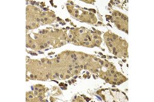 Immunohistochemistry of paraffin-embedded human stomach using SETD5 antibody (ABIN5974406) at dilution of 1/100 (40x lens). (SETD5 Antikörper)