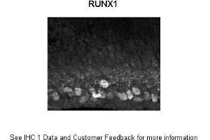 Sample Type : Mouse, post-natal day (p) 0 retinal ganglion cells Primary Antibody Dilution : 1:1500 Secondary Antibody : Donkey anti rabbit IgG Alexa 594 Secondary Antibody Dilution : 1:1000 Gene Name : RUNX1  Submitted by : Anonymous (RUNX1 Antikörper  (Middle Region))