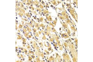 Immunohistochemistry of paraffin-embedded human stomach using CASP3 antibody at dilution of 1:100 (x400 lens). (Caspase 3 Antikörper)