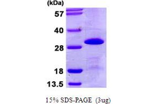 SNRPB2 Protein (AA 1-225) (His tag)