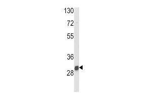 Western blot analysis of NAT2 Antibody in mouse kidney tissue lysates (35ug/lane) (NAT2 Antikörper  (C-Term))