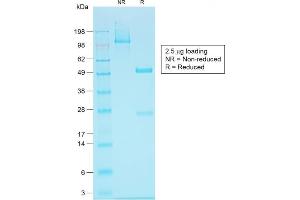 SDS-PAGE (SDS) image for anti-Epithelial Cell Adhesion Molecule (EPCAM) (AA 20-60), (N-Term) antibody (ABIN6939994)