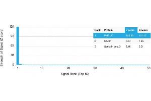 Analysis of Protein Array containing more than 19,000 full-length human proteins using gp100 Mouse Monoclonal Antibody (PMEL/2038). (Melanoma gp100 Antikörper  (AA 376-502))