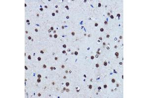 Immunohistochemistry of paraffin-embedded rat brain using TDP-43/TARDB Rabbit pAb  at dilution of 1:500 (40x lens). (TARDBP Antikörper  (AA 1-100))