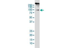 Western Blotting (WB) image for anti-Dual-Specificity tyrosine-(Y)-phosphorylation Regulated Kinase 1A (DYRK1A) (AA 674-763) antibody (ABIN560675)