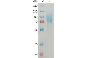 Mouse I Protein, His Tag on SDS-PAGE under reducing condition. (ICAM1 Protein (AA 28-485) (His tag))