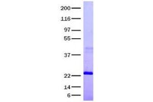 Validation with Western Blot (INHBA Protein)