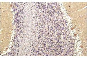 Immunohistochemistry of paraffin-embedded Human brain tissue using SGK1 Monoclonal Antibody at dilution of 1:200. (SGK1 Antikörper)