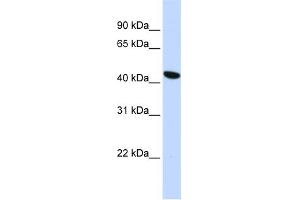WB Suggested Anti-TMEM117 Antibody Titration:  0. (TMEM117 Antikörper  (Middle Region))