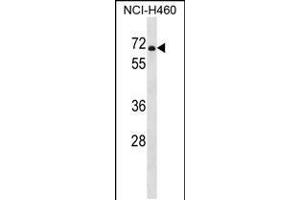 Western blot analysis in NCI-H460 cell line lysates (35ug/lane). (PDE1B Antikörper  (C-Term))