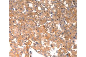 Immunohistochemistry (IHC) image for anti-Osteocalcin (BGLAP) antibody (ABIN2425623) (Osteocalcin Antikörper)