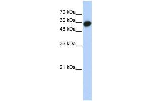 WB Suggested Anti-LRRC6 Antibody Titration: 0. (LRRC6 Antikörper  (Middle Region))