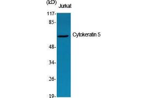 Western Blot (WB) analysis of specific cells using Cytokeratin 5 Polyclonal Antibody. (Cytokeratin 5 Antikörper  (C-Term))